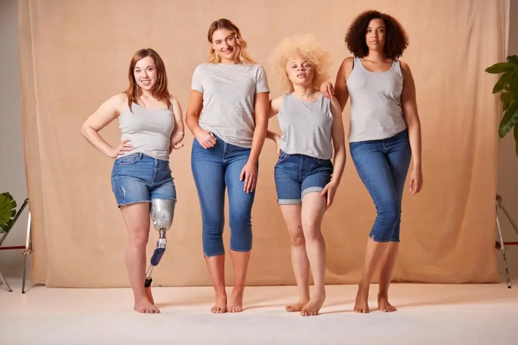 Lipödem erkennen – Frauen mit Lipödem im Alltag